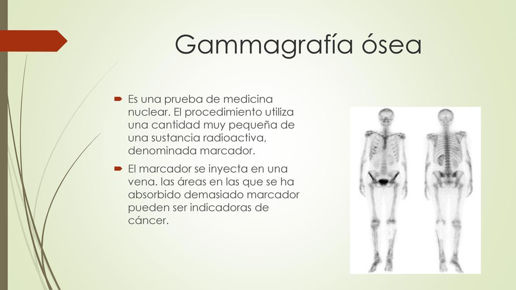 para que sirve una gammagrafía osea para que sirve una gammagrafía osea